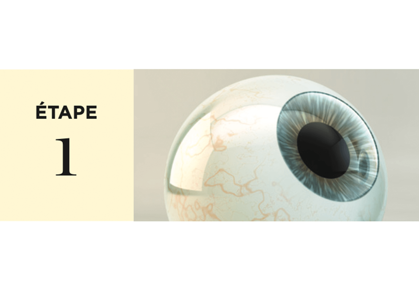 Oeil anesthésié par des gouttes