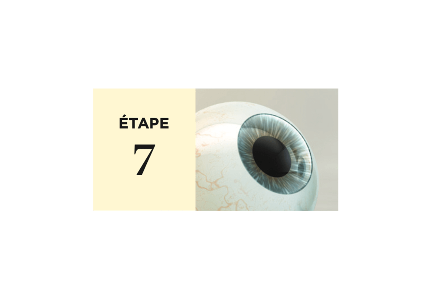Flap déposé sur la cornée et fin de la chirurgie.