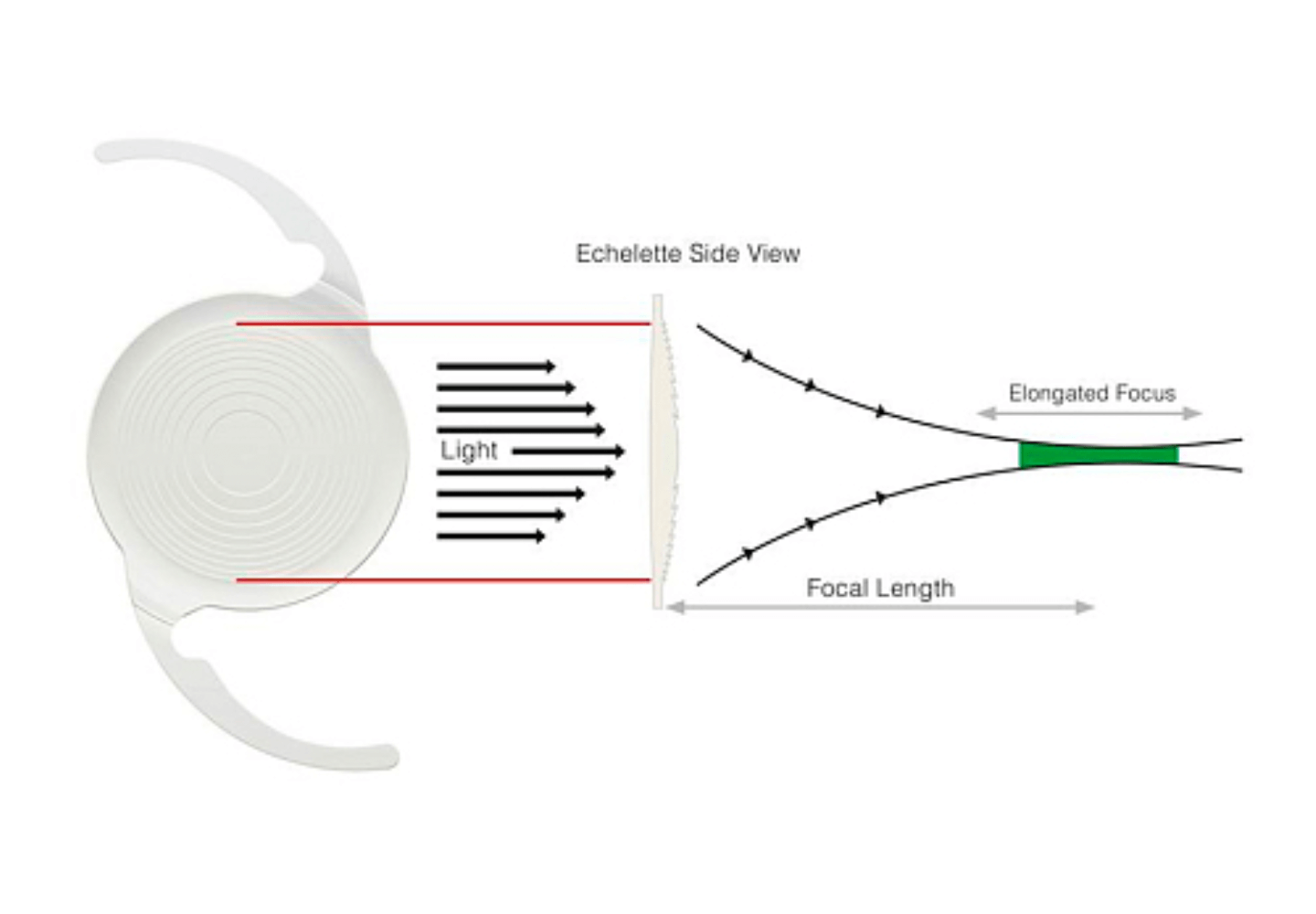 Trajectoire de la lumière lorsqu'elle traverse la lentille Symphony