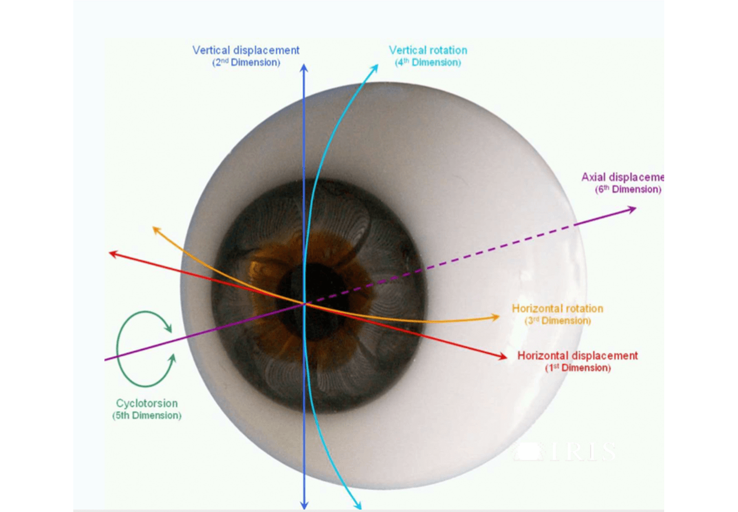 Schéma du système de tracking en six dimensions du laser Schwind Amaris 750s